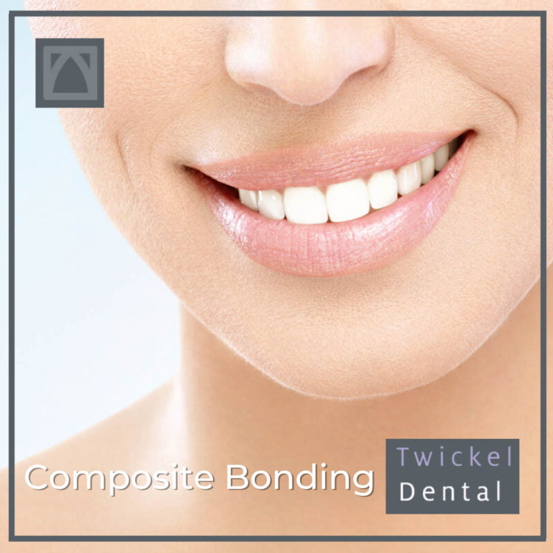 Composite Bonding Shropshire Shrewsbury Twickel Dental