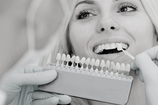 Smile makeover